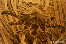 性传染病，除了艾滋病之外，你知道这些吗？图片