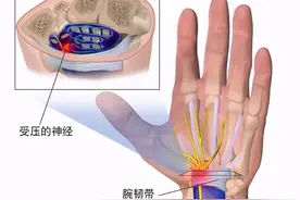 经常手麻、手痛，是血液循环不畅吗？不出意外，这5种可能性较大图片