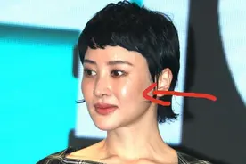 朴树妻子现身活动，瘦到皮包骨锁骨突兀，苹果肌僵硬脸肿到不敢认图片