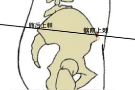 骨盆前倾的自救  告别假翘臀，迎来健康美图片