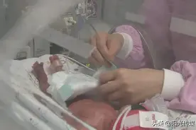 放心了！出生体重仅1公斤，德阳28周“袖珍宝宝”健康出院！图片