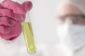 血肌酐降低，一定是好事吗？听听肾科专家怎么说图片