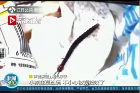 夏季高温潮湿 小心毒虫出没！常州2岁幼儿草丛玩耍被蜈蚣咬伤图片