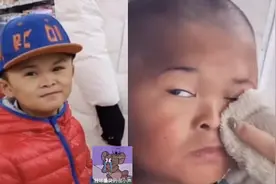 小马云“过山车式”的人生，13岁只会么么哒，还要靠人洗脸喂饭图片