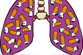 抽烟的人肺太脏怎么办？洗肺技术有用吗图片