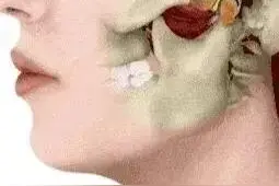夜间磨牙很正常吗？不！是病！得治图片