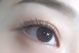 双眼皮术后越淡定越不肿图片