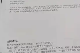 产检NT3.5，也可以是健康宝宝图片