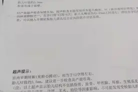 产检NT3.5，也可以是健康宝宝图片