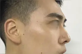 侧颜不够杀？别让下巴耽误了你的侧颜图片