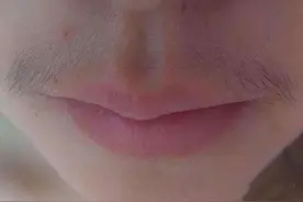 嘴上唇毛越来越重怎么办？坚持这三个土方法，28天唇毛永久远离你图片