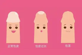 小孩子包皮过长怎么办？这3种情况不用割包皮，家长速看图片