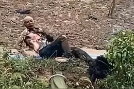 糊涂蛋！江苏一男子高压电线下钓鱼，不幸触电，全身被电的漆黑图片