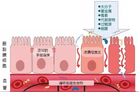 你的肠道“漏”了吗，5R调理方案图片