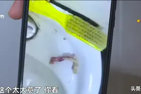 震惊！女子擤鼻涕擤出带血纱布图片
