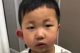 你被蚊子咬过最无语的位置是哪里？图片