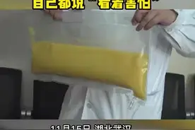 平时大鱼大肉，爱吃炸鸡，武汉一男子血液透析出2升油浆，自己都说“看着害怕”图片