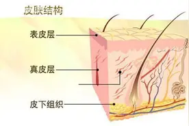 昕芙丽提醒激素依赖性皮炎的肌肤修复很重要图片