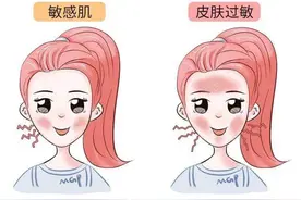 面颊泛红？修复面膜大盘点，成分党告诉你网红面膜到底怎么样图片