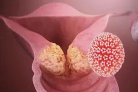 HPV男人也要打！四价和九价什么区别？记住这个号码帮你约疫苗图片