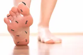 血糖高不高，低头看看脚，出现“两痛两痒”，小心血糖飙升图片