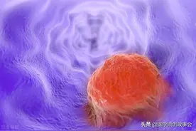 28天癌细胞“清零”，国内首例CAR-T治疗的患者出院，120万值吗图片