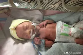 爸爸含泪记录｜我的宝宝是早产儿，出生直接进ICU，不会呼吸图片