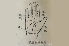 临床上遇到疑难杂症久治不愈，不妨试试割治疗法。图片