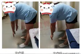 别把这种腰痛错当成腰椎间盘突出了，是骶髂关节发生了紊乱图片