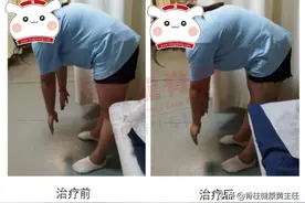 别把这种腰痛错当成腰椎间盘突出了，是骶髂关节发生了紊乱图片