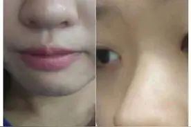 青春期女生常做3个动作改变鼻子 早晚逆袭成“女神”图片