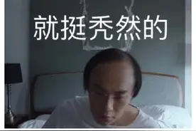 长得再帅，也怕秃顶，做到这几点，从此告别“光明顶”图片