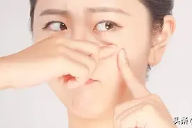 戴口罩爱长痘？不同部位长痘痘，看看哪里出了问题？图片