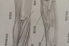 左肘屈曲（强直）的治疗图片