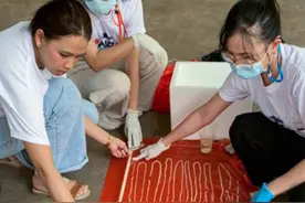 慎入！平时爱吃生牛肉，男子体内养着18米长寄生虫，猛一看像是项链图片