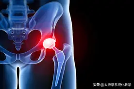 股骨头坏死之康复法——太极拳图片