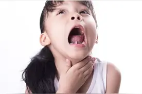 鱼刺卡住孩子喉咙怎么办？小儿科医师教正解图片