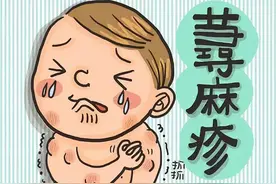 荨麻疹，瘙痒剧烈？3味中药，疏风止痒，有效解决瘙痒图片