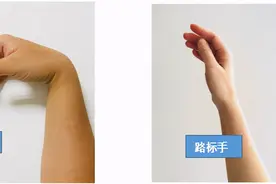 【图解】帕金森患者手部锻炼操分解动作图片