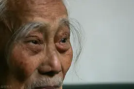 男人50岁之后眉毛变长意味着长寿？医生提醒：3大原因要心中有数图片