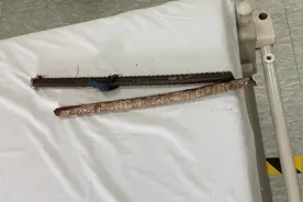 高空坠落被钢筋穿透胸腹 他奇迹般脱离危险 六院东院多学科打赢救命战图片