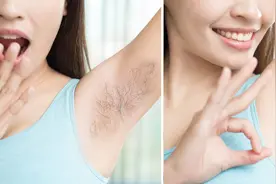 为什么有的女性腋毛旺盛，有的却“光秃秃”？哪种有利于健康？图片