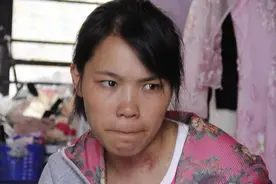 爸爸死了妈妈改嫁，8岁姐姐独自带大俩妹，成年后却面临生死抉择图片