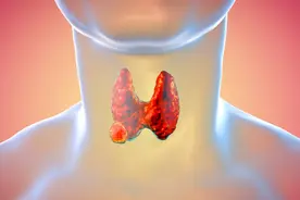 橘子是甲状腺结节发物？建议：保护甲状腺，3种水果还需少碰图片