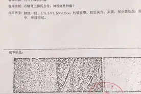 患者花5万切瘤后不理赔 太平洋保险：良性肿瘤不在保障范围图片