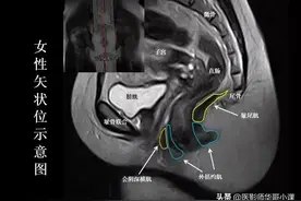 「高清解剖」磁共振盆底MRI解剖详解图片
