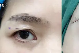50岁只是做了提眉术，“年轻”这么多，值了图片