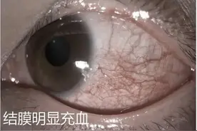 辣眼睛！深圳的虫子实在太太太多了图片