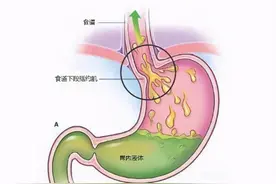 得了这种病，睡觉要抬高床头！注意，不是垫个枕头图片
