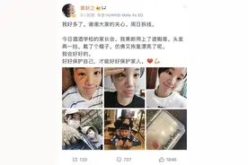 酒店卫浴间成高危场所？章龄之被摔致面部缝针，抹遮瑕膏掩盖图片